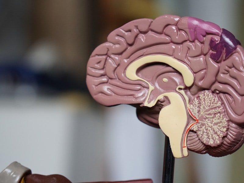 Anatomical brain model — traumatic brain injury and concussion cases